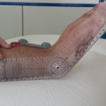 Consejos fisioterapéuticos para la vuelta a casa tras un implante de prótesis Consejos fisioterapéuticos para la vuelta a casa tras un implante de prótesis