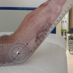 Los masajes fisioterapéuticos y sus beneficios para personas con prótesis de muñeca Los masajes fisioterapéuticos y sus beneficios para personas con prótesis de muñeca