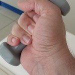 Fisioterapia para personas con prótesis de muñeca en su puesto de trabajo Fisioterapia para personas con prótesis de muñeca en su puesto de trabajo