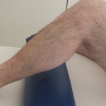 La vuelta al trabajo con tu prótesis de rodilla, consejos fisioterapéuticos La vuelta al trabajo con tu prótesis de rodilla, consejos fisioterapéuticos