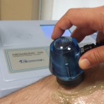 Servicios de fisioterapia para la rehabilitación tras un trasplante de rodilla en Gernika Servicios de fisioterapia para la rehabilitación tras un trasplante de rodilla en Gernika