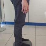 Recuperar la estabilidad tras un implante de prótesis de rodilla Recuperar la estabilidad tras un implante de prótesis de rodilla