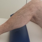 La vuelta al trabajo con tu prótesis de rodilla, consejos fisioterapéuticos