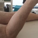 La importancia de la terapia fisioterapéutica diaria en personas con prótesis de rodilla