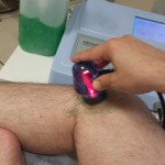 Fisioterapia de mantenimiento en personas con prótesis de rodilla