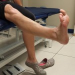 Ejercicios avanzados en rehabilitación tras prótesis de rodilla